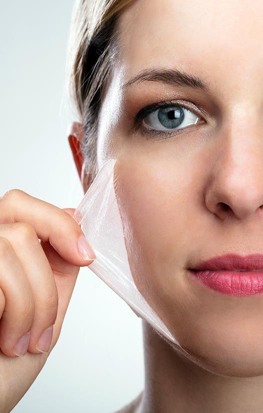 pictures of a chemical peel