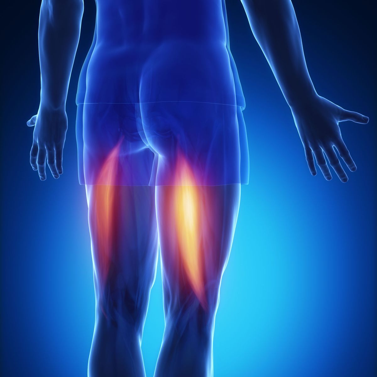 pictures of a torn hamstring